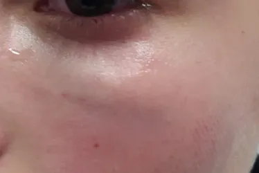 El afectado.