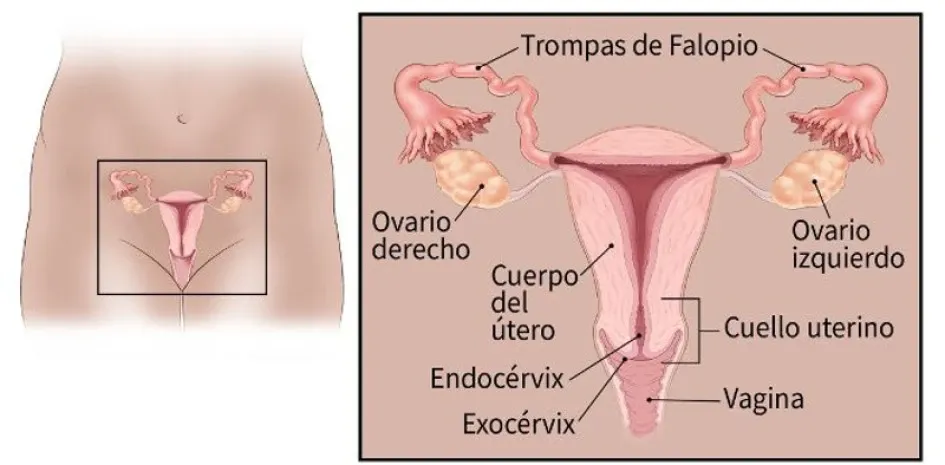 Siga las recomendaciones médicas para evitar el cáncer de cuello uterino. No deje pasar el tiempo: Si desarrolla síntomas, consulte con un especialista en el menor tiempo posible. Cuello uterino