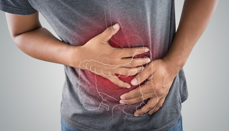 Enfermedad Inflamatoria Intestinal (EII) Salud