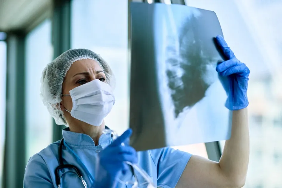 Una radiografía de tórax resulta una prueba complementaria en la detección de la tuberculosis. Si tiene los síntomas descritos, consulte a un médico en el menor tiempo posible. Una radiografía de tórax resulta una prueba complementaria en la detección de la tuberculosis. Si tiene los síntomas descritos, consulte a un médico en el menor tiempo posible.