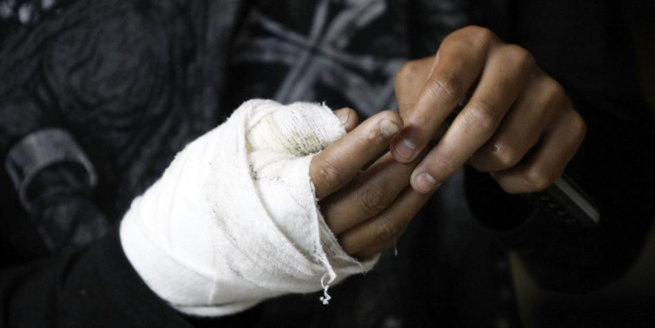 La Dorada reporta un nuevo caso de quemados con pólvora; ya son 15 en Caldas La Dorada reporta un nuevo caso de quemados con pólvora; ya son 15 en Caldas