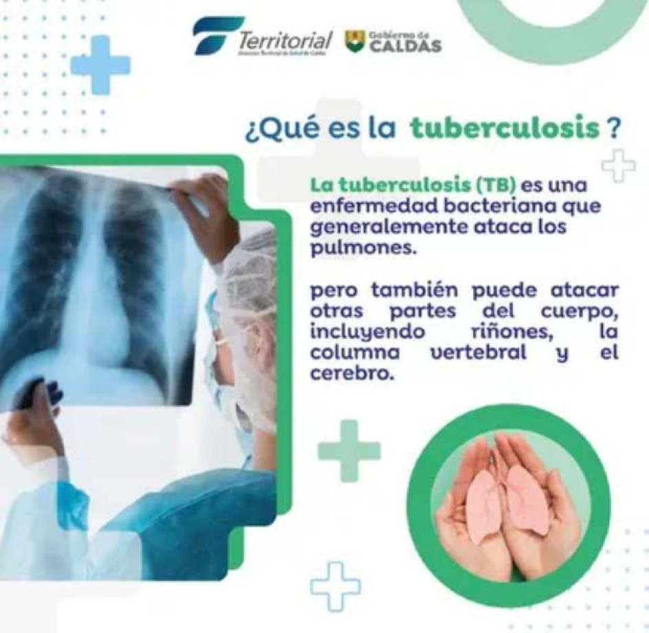 Las cifras de tuberculosis en Caldas en los úlitmos meses reflejan una distribución preocupante de la enfermedad en varias zonas del departamento. Así lo alerta la Dirección Territorial de Salud. Las cifras de tuberculosis en Caldas en los úlitmos meses reflejan una distribución preocupante de la enfermedad en varias zonas del departamento. Así lo alerta la Dirección Territorial de Salud.