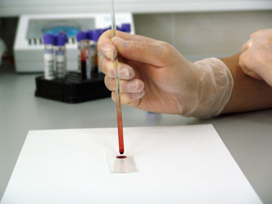 Prueba Sangre
