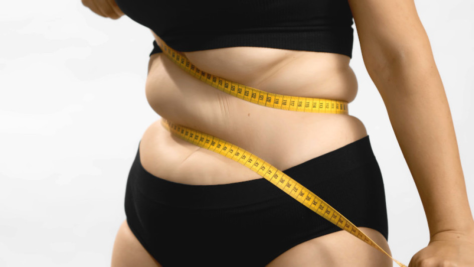 Obesidad Salud