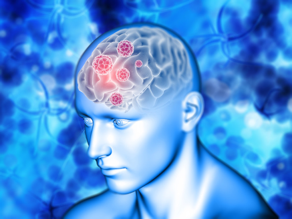 Ictus Salud