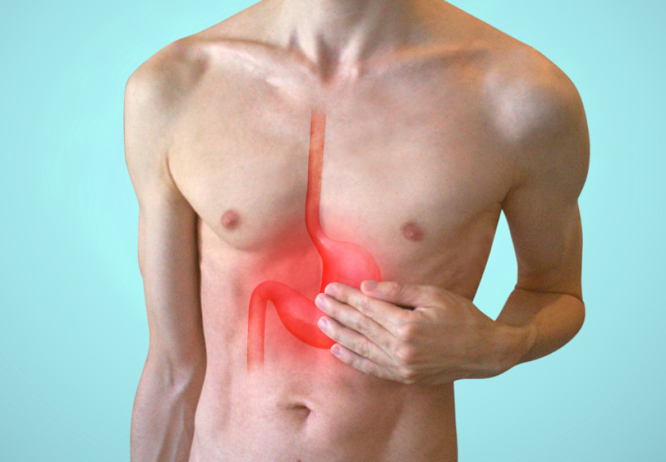 Estómago Gastritis