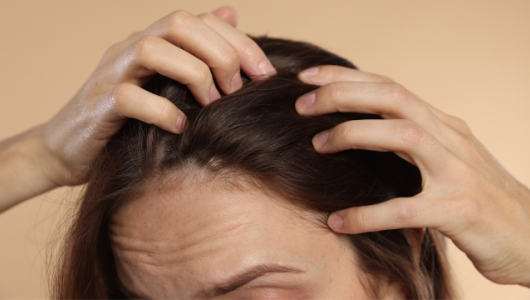 Cortisol y caída del cabello: la hormona del estrés que afecta su pelo