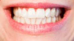 Cuide su sonrisa y viva tranquilo: evite los dolores dentales